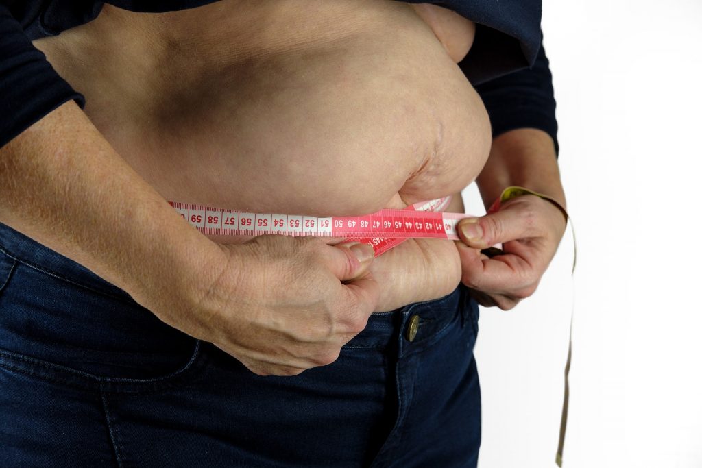 9 rizikových faktorov obezity: Aké sú jej stupne a druhy?